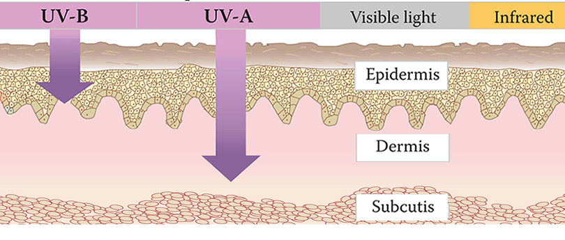 UV-Phototherapy-LED